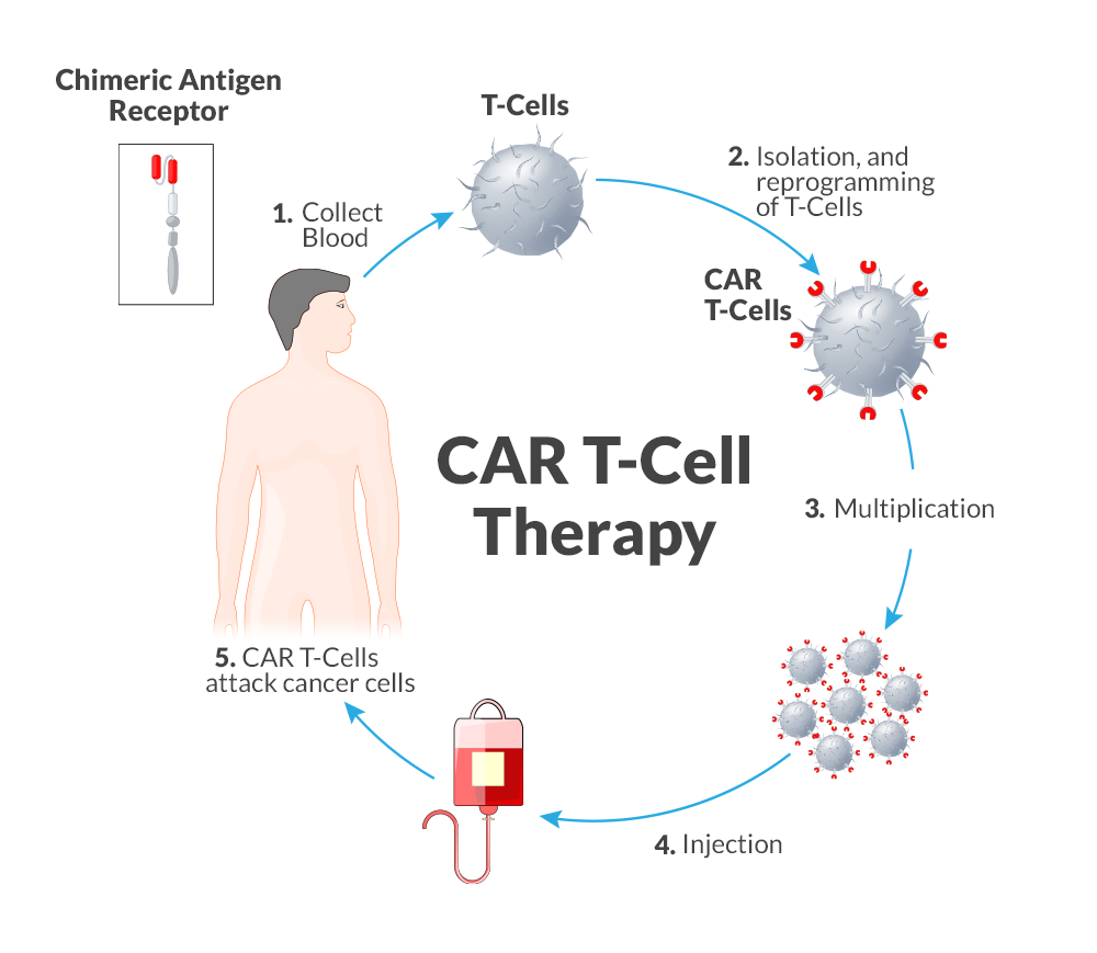 CAR-T 细胞疗法的流程
